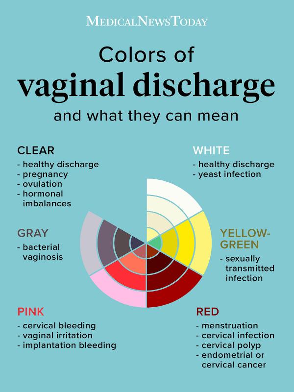 what-is-vaginal-discharge-symptoms-causes-diagnosis-and-treatment